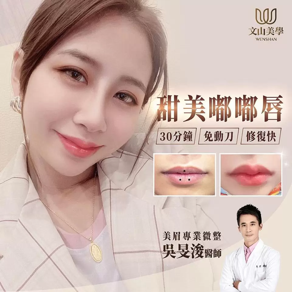 想要性感嘟嘟唇可以嗎？吳旻浚醫師 美眉專業微整