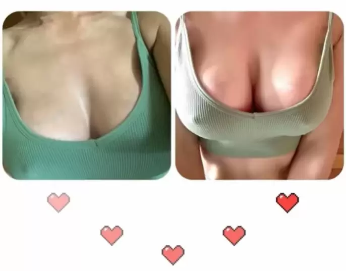 達特楊醫療聯盟 高雄果凍隆乳 院內案例