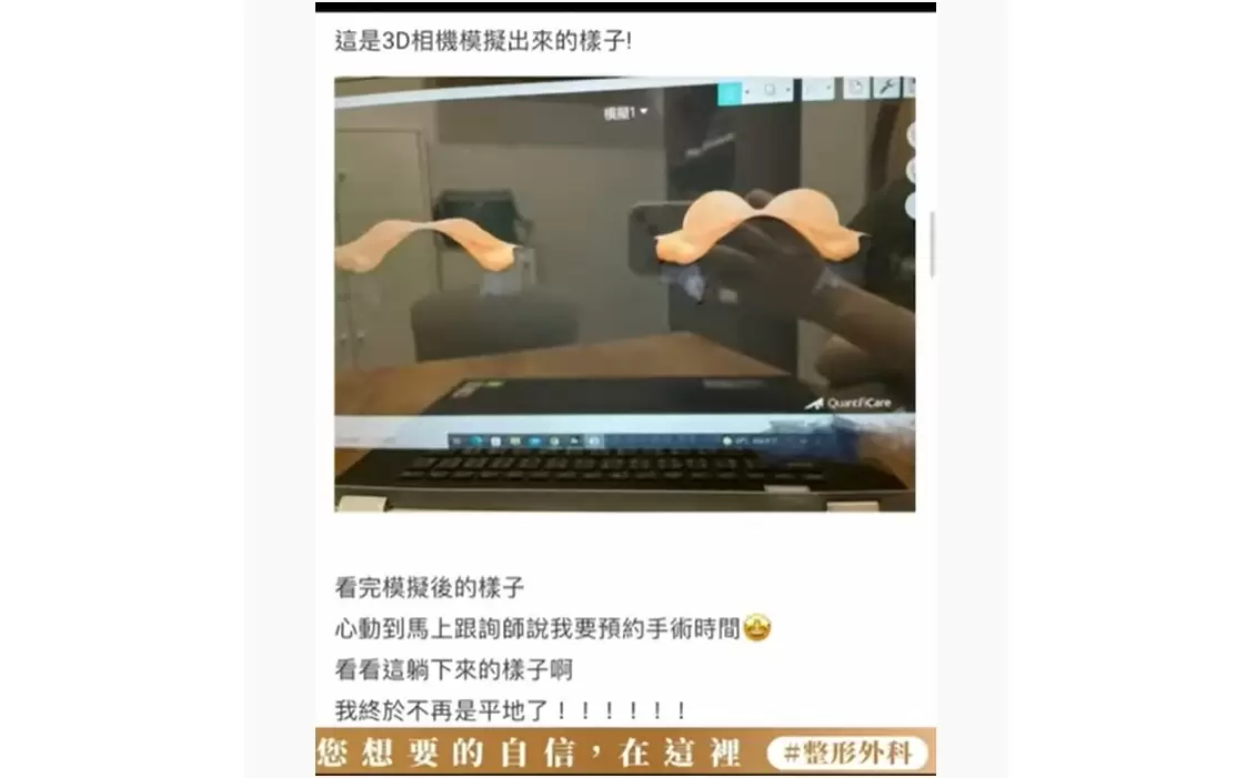 內視鏡隆乳 3D虛擬實境系統 達特楊醫療聯盟 高雄整形外科鄭鴻宜醫師