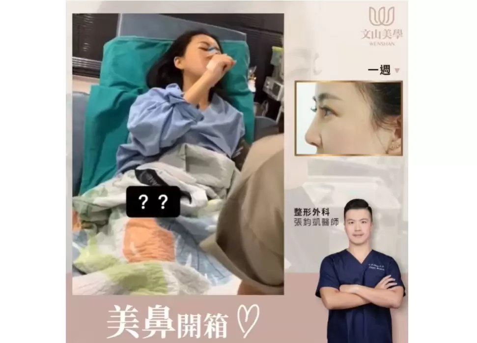 美鼻開箱漏網鏡頭 高雄整形外科張鈞凱醫師