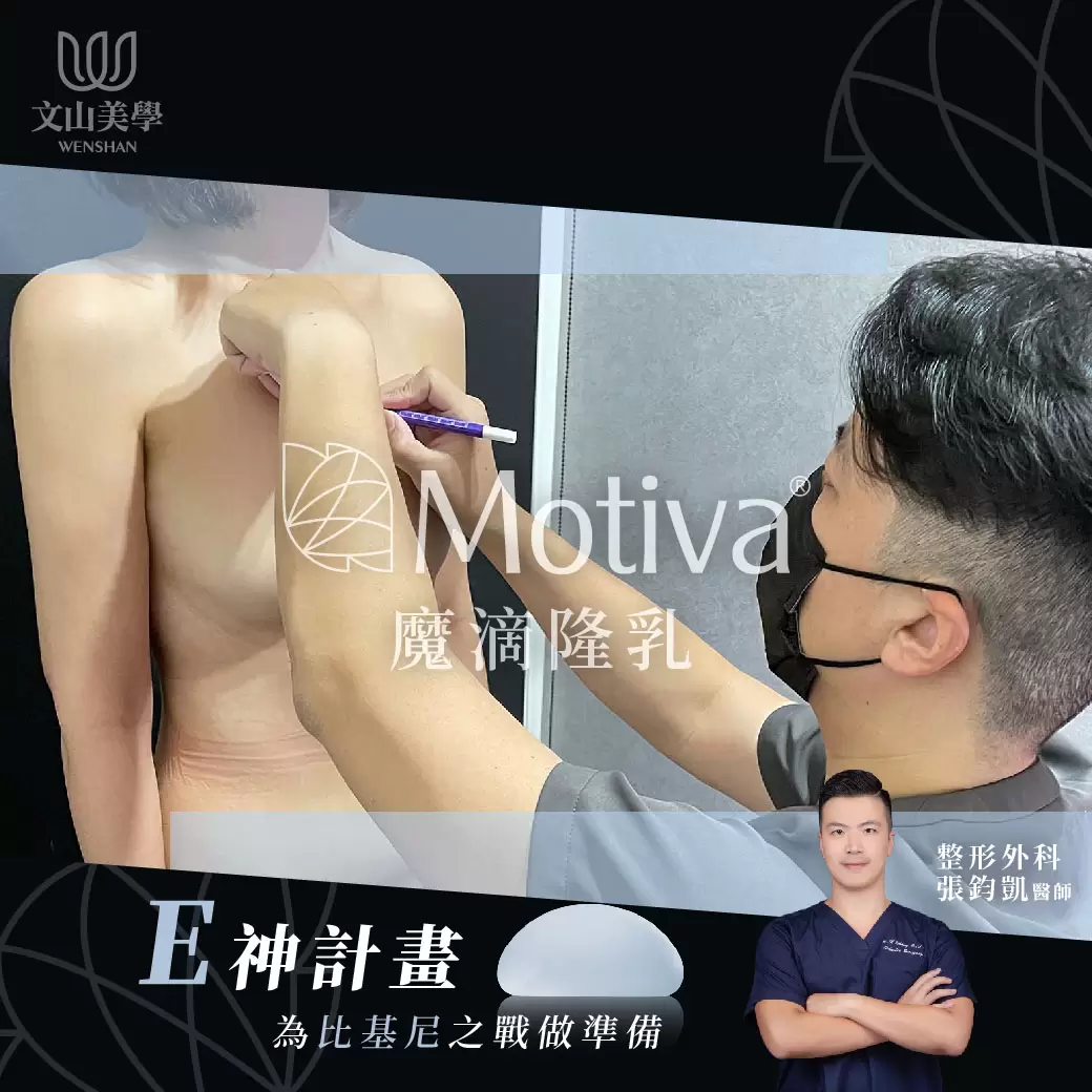 高雄整形外科張鈞凱醫師｜E神計畫 高雄魔滴隆乳