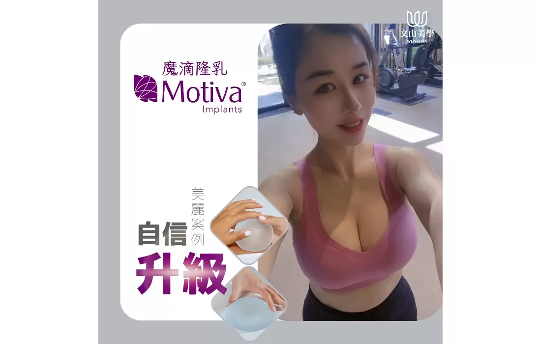 隆乳熱浪持續延燒 魔滴隆乳 高雄整形外科張鈞凱醫師 