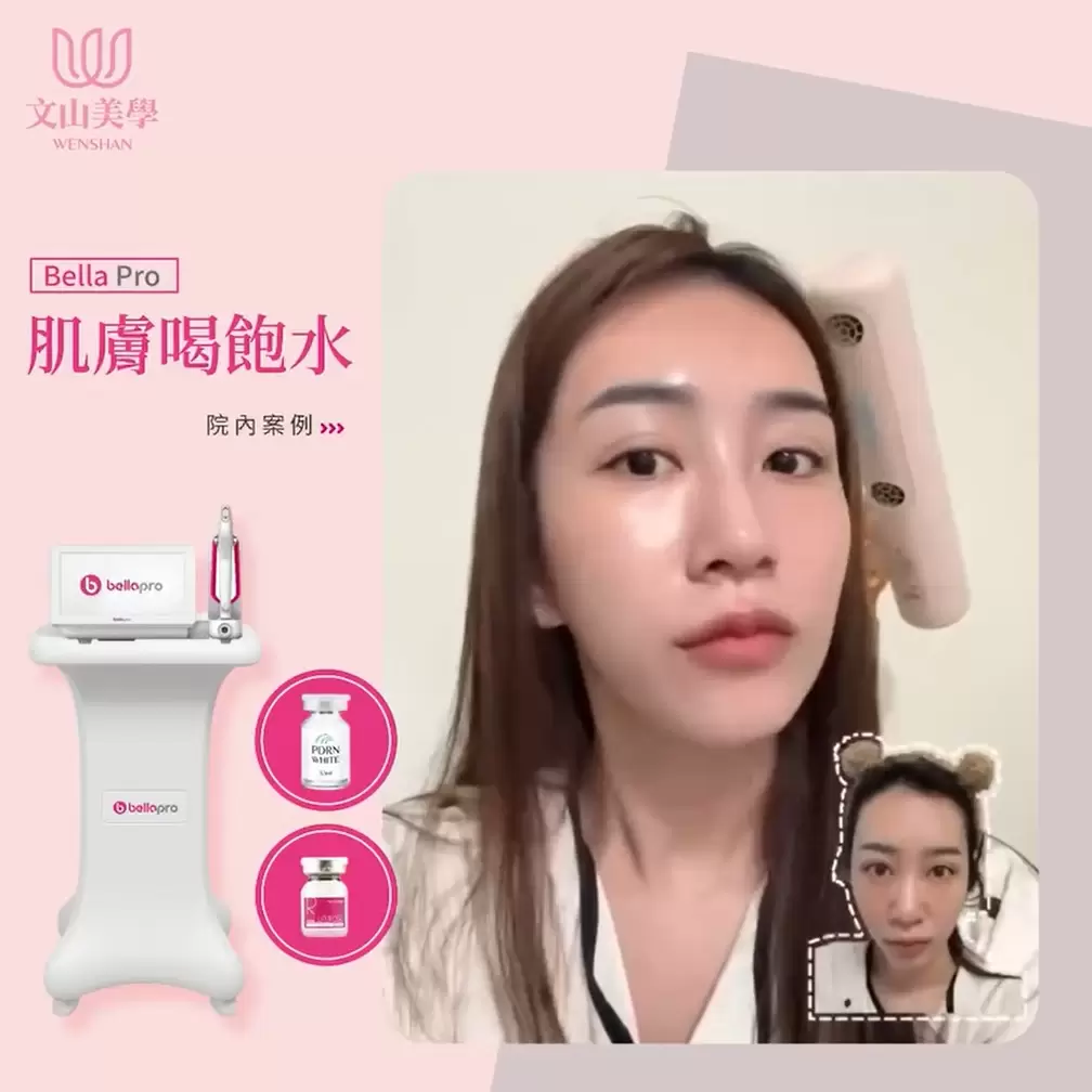 水光注射把超強保濕精華直送肌底 不只肌膚內在飽水 外在水嫩透亮閃閃發光