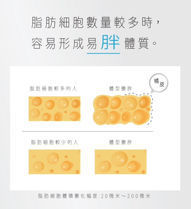 透過抽脂手術減少體內脂肪細胞數量
