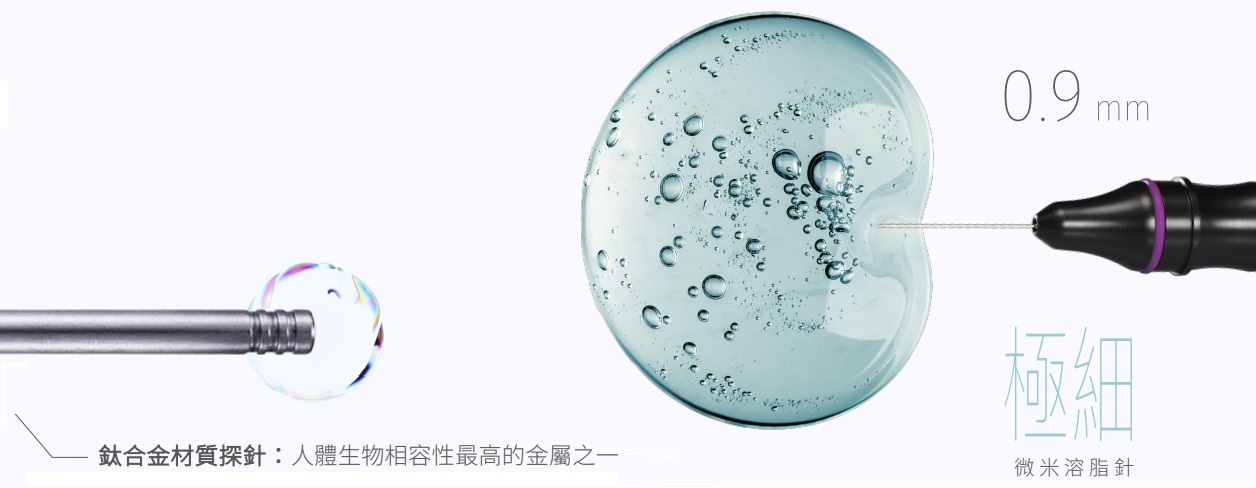 臉部專屬超音波頻率，直徑不到1毫米的溶脂針。專為臉部抽脂而誕生的音波脂雕。